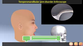 TMJ Arthroscope screenshot 0