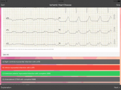 ECG Master: Quiz & Explanation screenshot 8