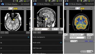 3-D brain Atlas screenshot 0