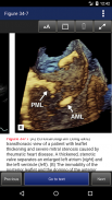 Cardiac Surgery in the Adult, 5th Edition screenshot 16