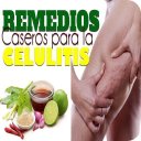 Remedios Caseros para Celulitis