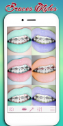 Braces Photo Editor screenshot 1