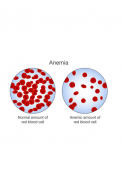 anemia screenshot 0