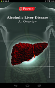 Alcoholic Liver Disease screenshot 4