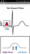 Easy ECG screenshot 1