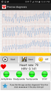 การวินิจฉัยโรคหัวใจ (อัตราการเต้นของหัวใจ) screenshot 3